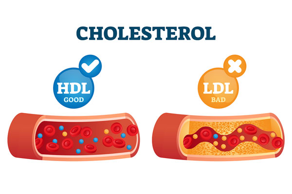 cholesterol ldl